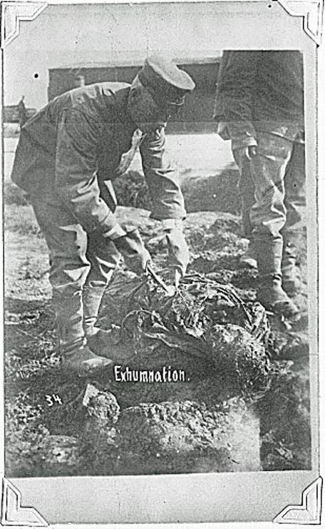 WW1 Exhumnation of human remains